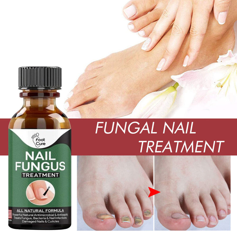 Nails Toes Care Painless Nail Fungus Treatment Nail Repair Liquid Fungus Serum