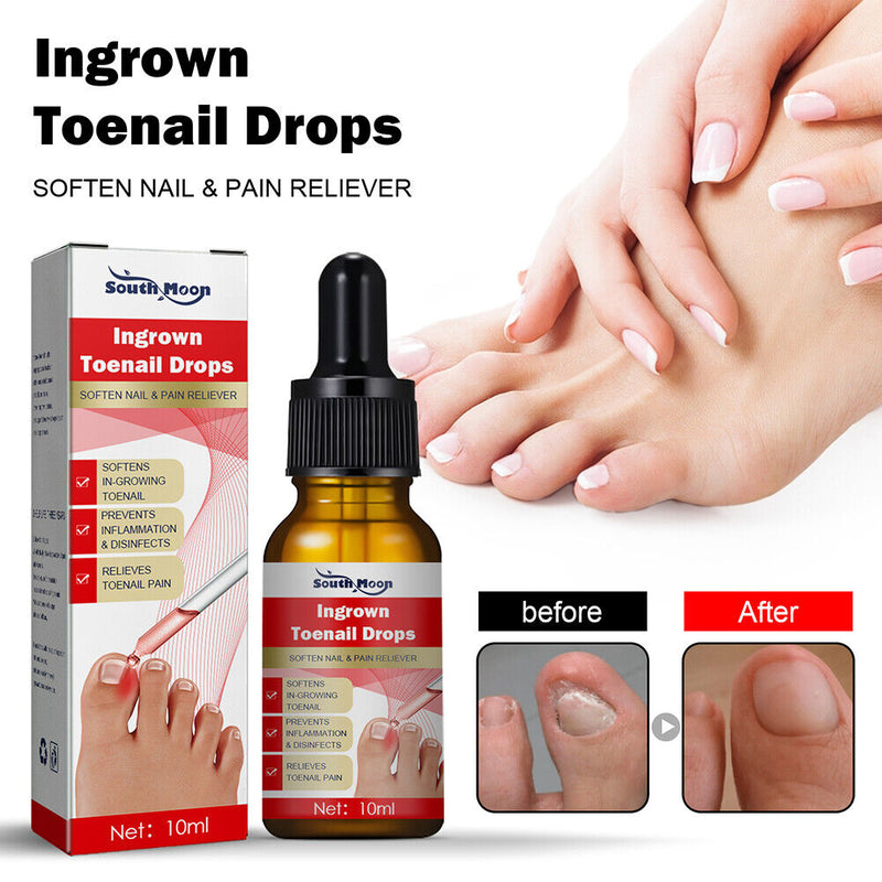 Ingrown Toenail Treatment Serum Nail Correction Recover Oil Pain Reliever