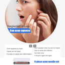 4pcs Practical Blackhead Remover Beauty Squeeze Tools Spots Acne Needle Kit