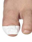 Ingrown Toenail Correction Tools Pedicure Recover Embed Toenail Treatment