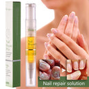 Beauty Moisturizing Enhance Damaged Cuticles Nail Cuticle Care Nail Repair Oil