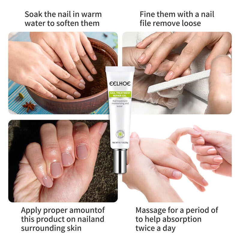Paronychia Treatment Toe Health Foot Care Anti-Infection Gel