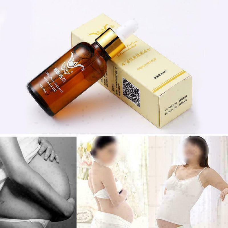 Essential oils For Stretch Marks Remover Strong Strength S5V5 Mark Removes U4T7