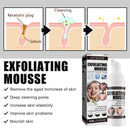 60ml Facial Exfoliating Mousse Deep Remove Cleaning Peeling Gel Skin Care Smoot&