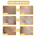 White Rice Whitening Serum Moisturizer Acne Fine Line C1N1 Treatment B4R6