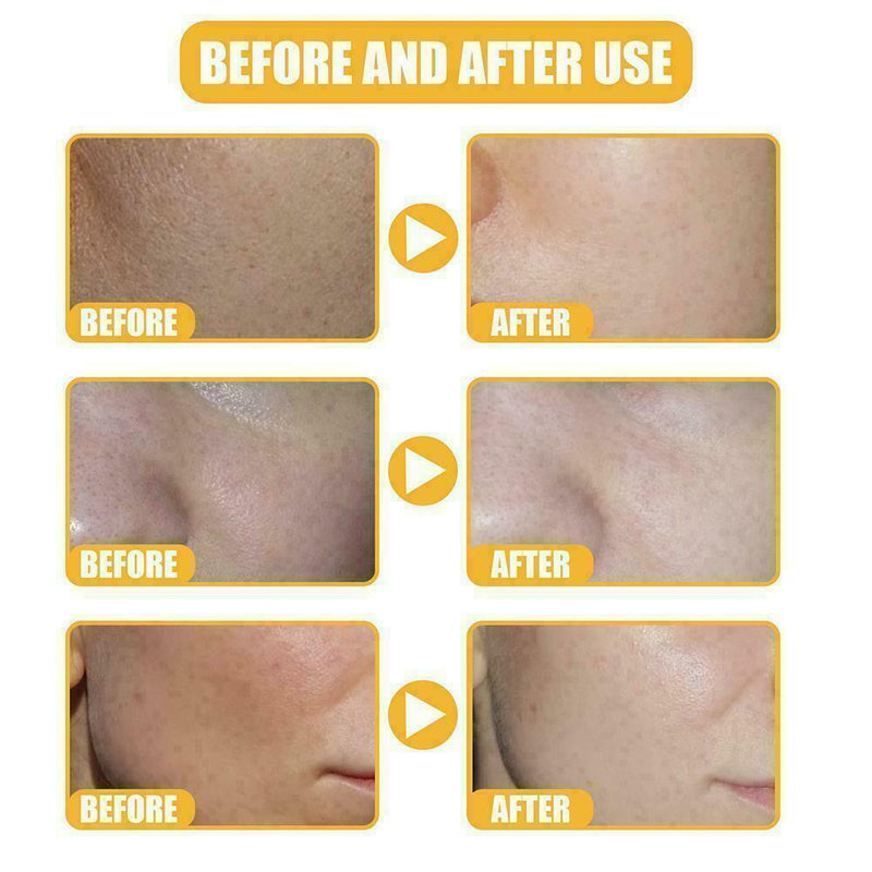 White Rice Whitening Serum Moisturizer Acne Fine Line C1N1 Treatment B4R6