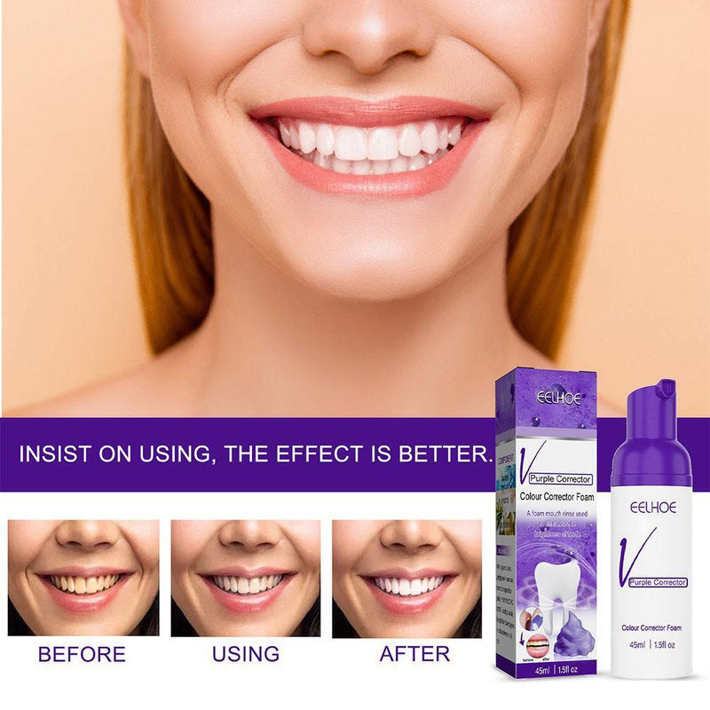 Foaming Whitening Toothpaste Cleans Tartar Stains Fresh Breath Whitens Teeth`