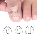 Ingrown Toe Nail Correction Hook/Rubber Band Paronychia Orthosis Corrector Clips