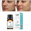 Nose Up Heighten Rhinoplasty Essential Oil 10ml Nasal BEST R6J3 Rmodeling T9J6