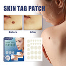 Skin Tag Remover Patches Acne Pimple Moles Wart Remover 144 Pcs`