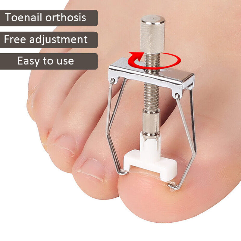 Fixer Ingrown Nail Correction Tool Pedicure Foot Embed Nails Care Corrector Set