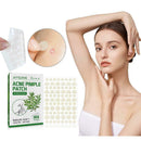 Tea Tree Oil Acne Patch Face Skin Repair Care Acne Makeup 4pcs(144pcs) W2A8