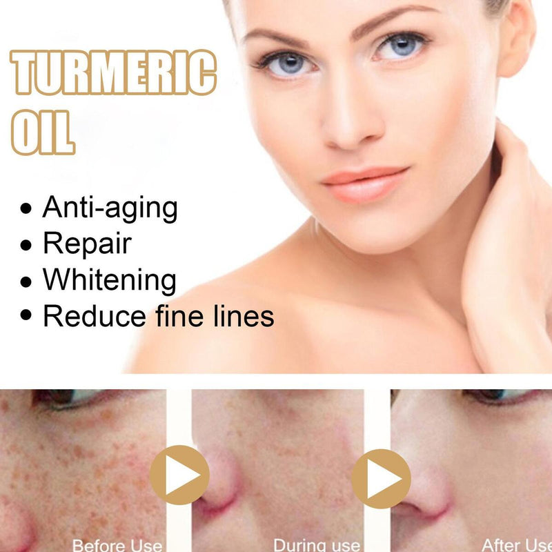 30ML Turmeric Face Serum Turmeric Dark Spot Corrector Serums Corrector Remover~