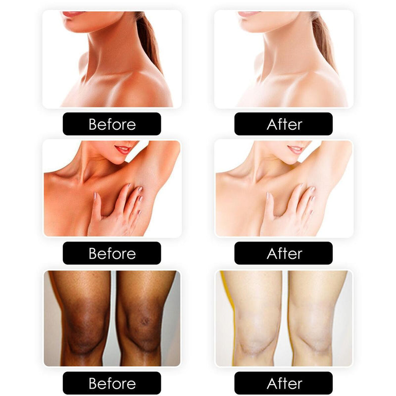 Whitening and Brightening Soap Joint Elbow Skin Brightening Body Moisturizing`