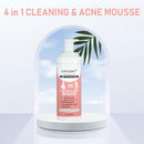 Facial Exfoliating Mousse Peeling Gel Face Scrub Deep Remove Cleaning All Skin