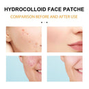 Tag Remover Patch Ance Pimple Patches Acne Spot Treatment Hydrocolloid Master
