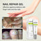 Paronychia Treatment Toe Health Foot Care Anti-Infection Gel