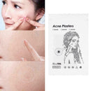 Cosrx Acne Pimple Master Patch 24 Patches Face Spot Treatment Scar Care G0K1