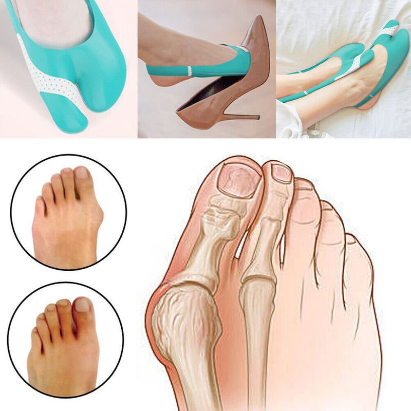 Toes Separator Foot Care Tools Hallux Valgus Orthotics Bone Thumb Correctors
