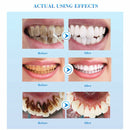 Care Coffee Tea Oral Hygiene Teeth Whitening Serum Gel Stain Remover Dentifrice