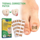 50pcs Paronychia Treatment Patch Waterproof Recover Corrector Pedicure Tool