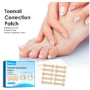 Ingrown Toenail Corrector Patches Treatment Tools for Inner Roll Armor Recovery