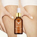 Stretch Marks Remover Essential Oil Eliminate Pregnancy Scars Maternity X7Y9
