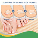 Ingrown Toenail Correction Stickers Nail Corrector Patches Nail Care Tool!