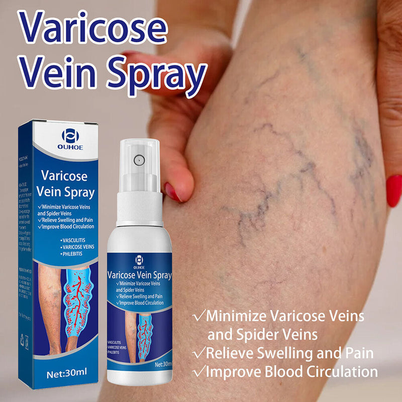 Varicose Vein Spray Sooting Leg Acid Bilges Itching Solution Body Care 30ml