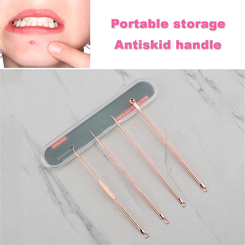 4pcs Practical Blackhead Remover Beauty Squeeze Tools Spots Acne Needle Kit