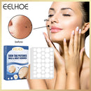 144pcs Skin Tag Remover Patches Wart Treatment Herbal Stickers Plasters Newly
