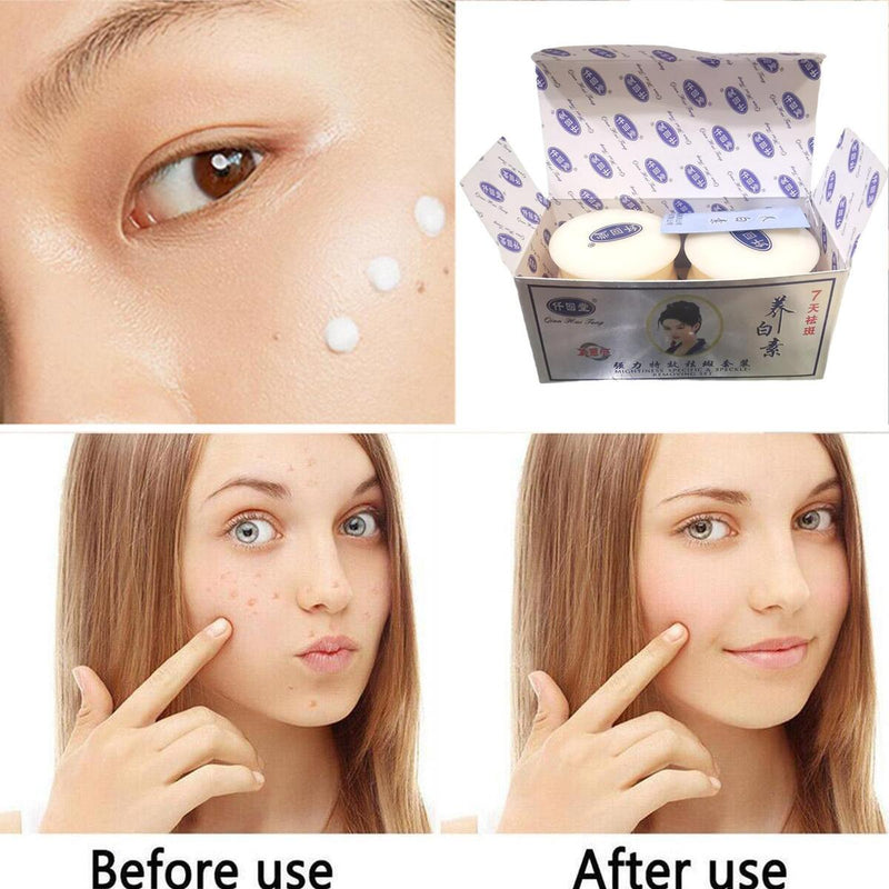 Aufhellende Anti-Freckle-Gesichtscreme Dark Spot Corrector Woman Face Care.