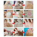 24pcs Feet Warts Remover Pads Foot Callus Corn Stickers Foot Care Plaster