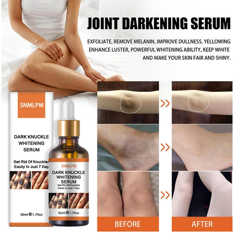 Serum Whitening Removing Dark Knuckles Serum Hand knuckle Eraser Serum Elbow`