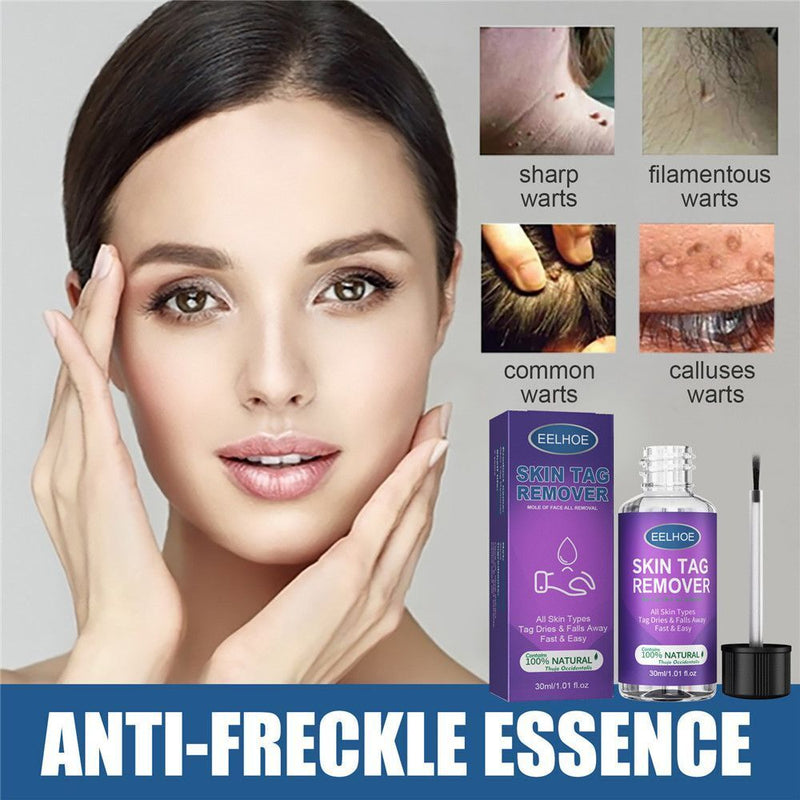 Wart Treatment Liquid Anti Verruca Remedy Warts Remover Removing Against Moles