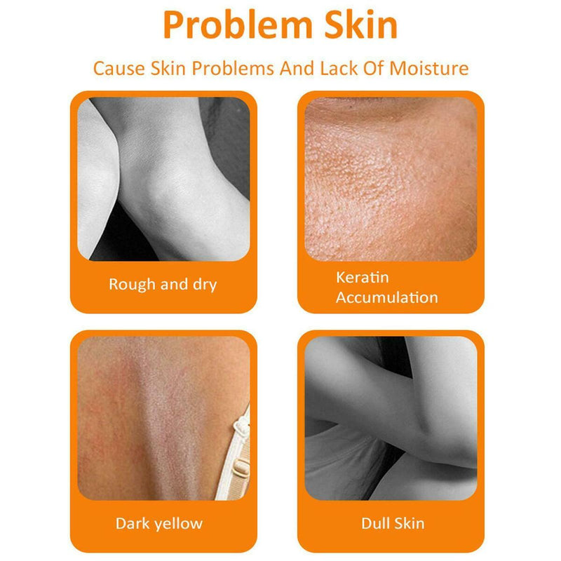 Orange Peeling Gel Skin Finger Knee Darkness Brighten Whitening Body K9B0