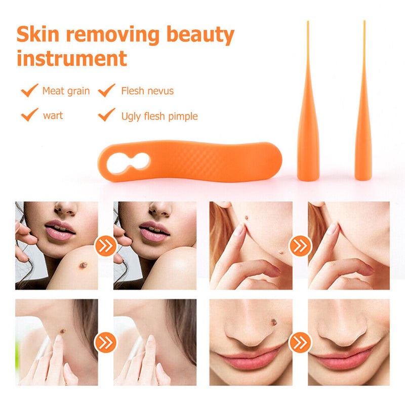 Mini Mole Wart Remover Facial Equipment Body Care with Cleansing Swab for Adults
