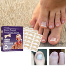 50pcs Stickers Ingrown Toenail Correction Stickers Nail Corrector Patches
