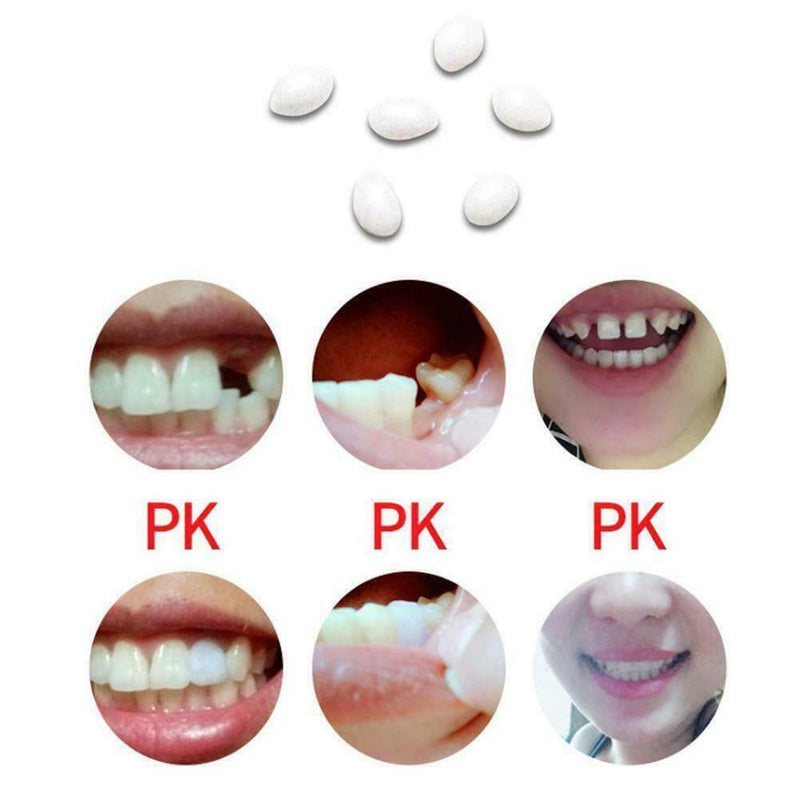 Temporary Tooth Replacement Material - 12 grams, 20ml, Repair teeth. Kit L0S4