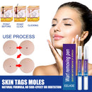 2pcs Wart Remover Skin Tag Pen Safe Herbal Ingredients Medicine Ointment Tools