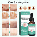 Narbenentfernung Ätherisches Öl Dehnungsstreifen Akneflecken Narbenchirurgie.