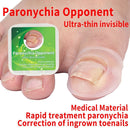 Straightening Clip Brace Medical Material Ingrown Toenail Correction Tool