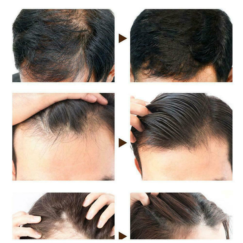 60Ml Anti-Drop Hair Care Lotion Polygonum Multiflorum Ginger Top Shampoo H3V4