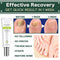 Paronychia Treatment Toe Health Foot Care Anti-Infection Gel