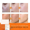 Orange Whitening Facial Soap Handmade Bleaching Face S7S4 S4O6
