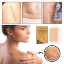 Tattoo Scar Flaw Conceal Tape Concealer Waterproof-Stickers-Cover-Up Ultra N7A5