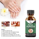 Fungal Nail Repair Essence Care Treatment Whitening Foot Nail Gel T6W5