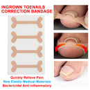 Ingrown Toenail Concealer Fixer Recover Pedicure Nail Patch Foot Care Tool Kit