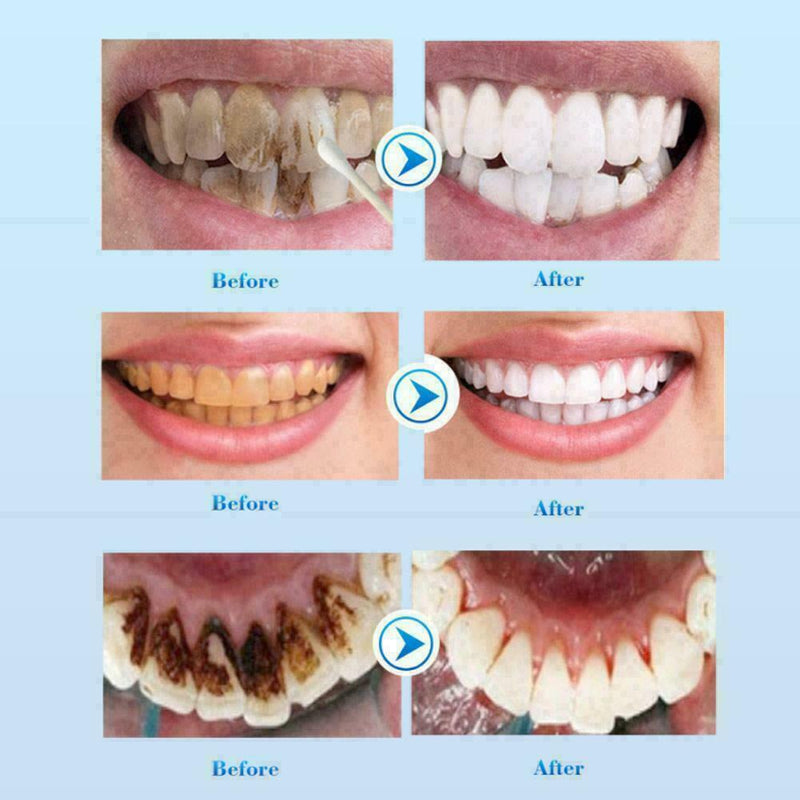 New Whitening Toothpaste Teeth Whitening Oral Cleaning Remove Stains Dental R0H3
