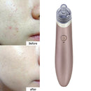 Facial Blackhead Remover Pore Cleaner Vacuum Peeling Dead Skin Acne Device